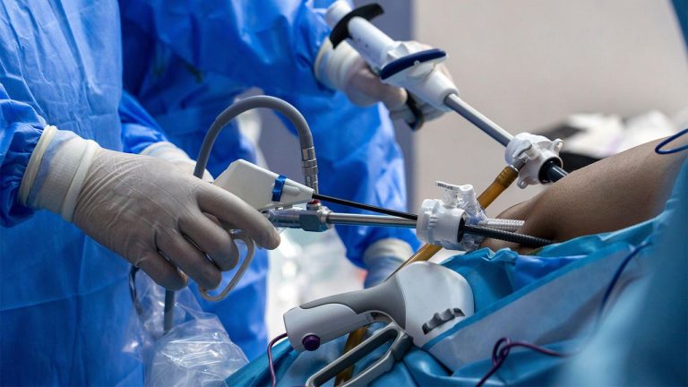Foundation provides free plastic body reconstruction surgeries in Sokoto Surgery