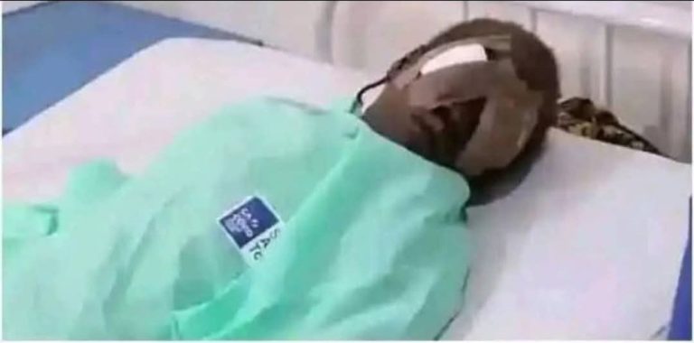 Brother plucks out 7-year-old sister’s eyes for money ritual in Bauchi