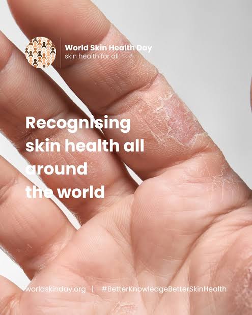 Dermatologist, Kano residents call for healthy skincare practices